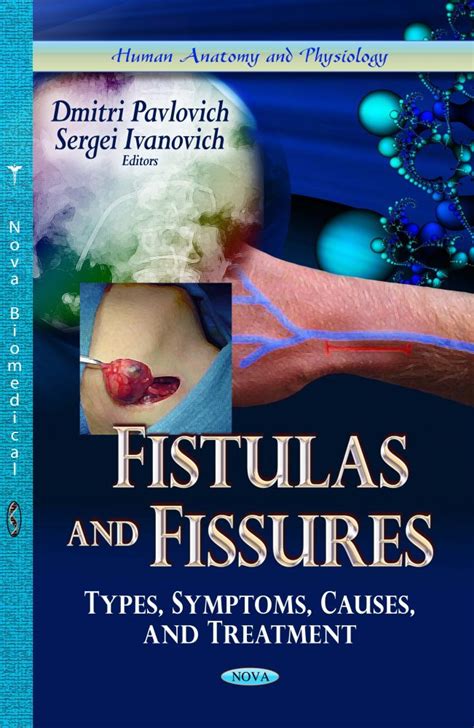 fistulae|Fistula: Causes, Symptoms, Types, and Treatment .